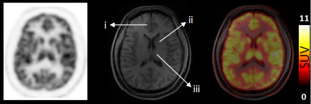 FTC146 brain scan